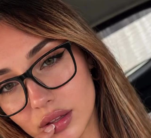 Девушка показала, что бывает, если не переболеть ветрянкой в детстве