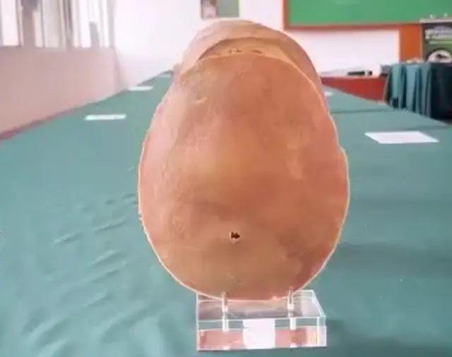 Срез реальности: анатомия, застывшая в полимере⁠⁠