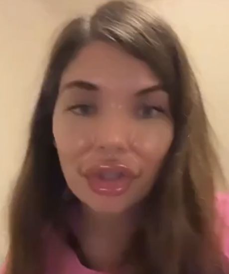 "Чё с устьем?"