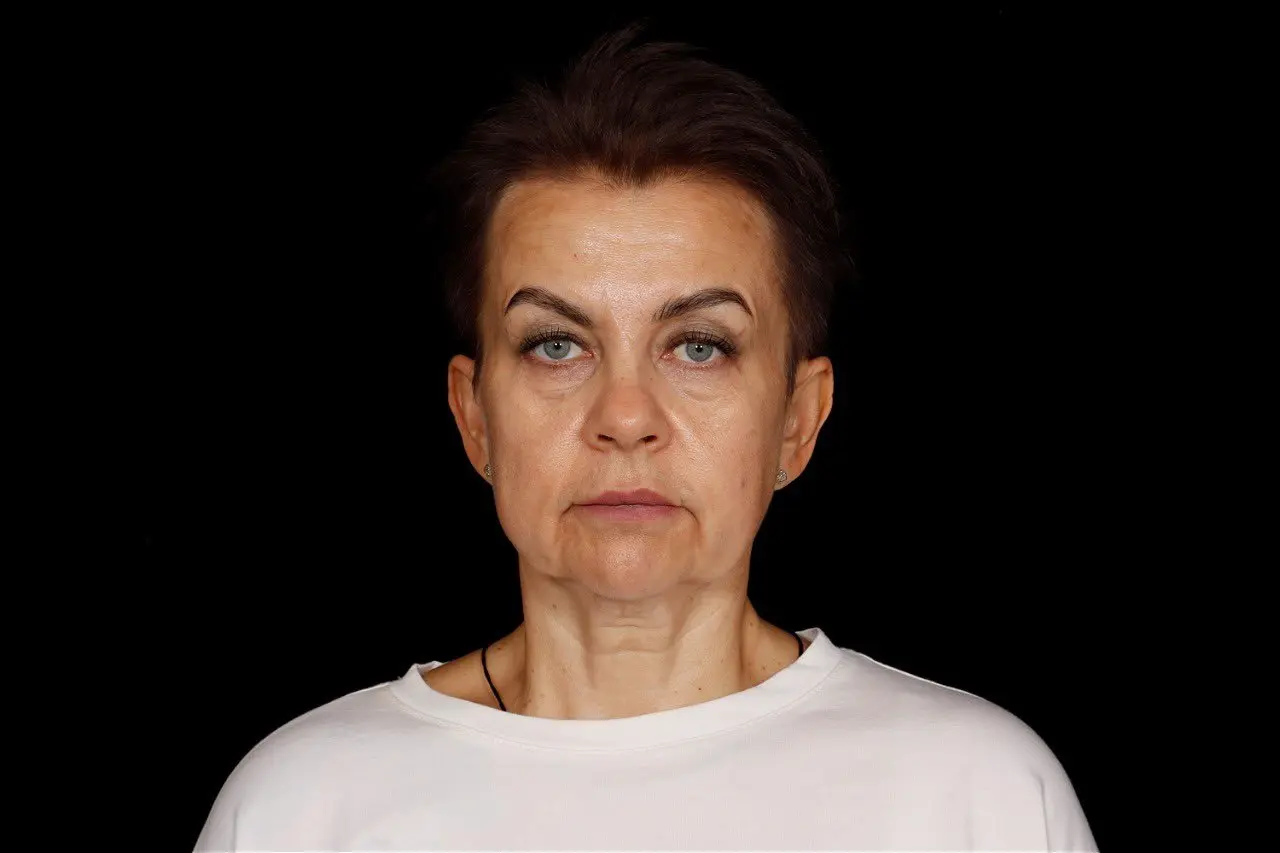 Это сколько тут плаcтический хирург бабушке лет скинул?