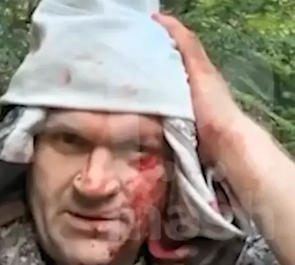 Нападение медведя в Якутии: раненый охотник выжил и сам дошел до людей